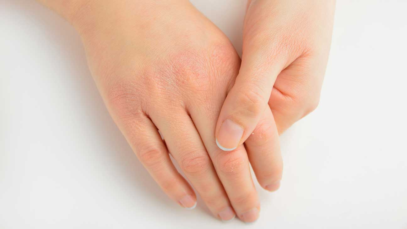 عکس دست های خشک شده یک زن