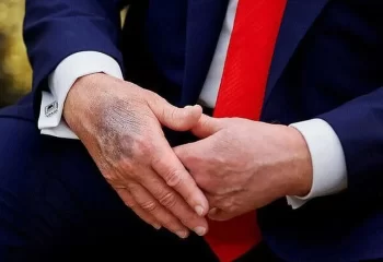 افشاگری کارشناس شبکه افق: ترامپ زنده است اما شرایط مساعدی ندارد!