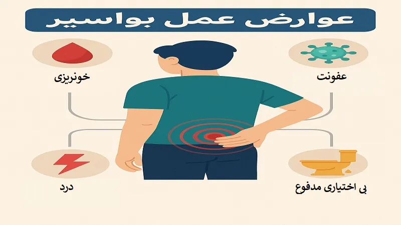 عوارض عمل بواسیر