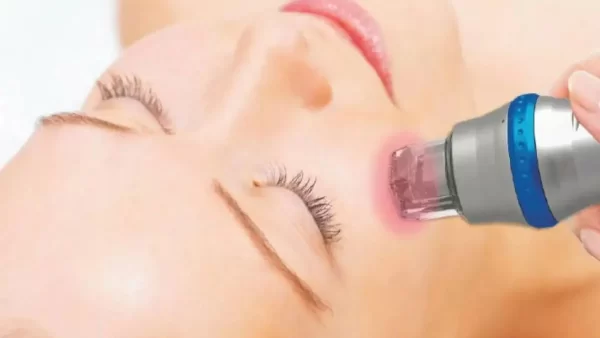 مقایسه لایه برداری شیمیایی با آر اف فرکشنال در جوانسازی پوست