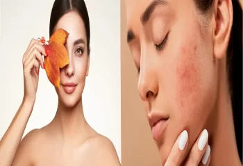 مراقبت از خشکی پوست در پاییز