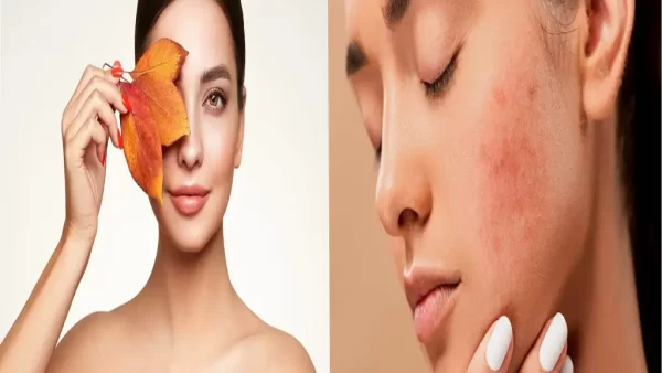 مراقبت از خشکی پوست در پاییز