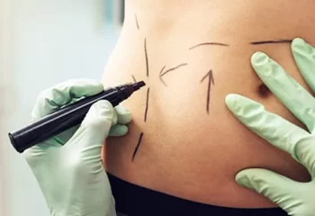 آمار تکان‌دهنده چاقی در ایران، آیا جراحی لاغری راه توقف دیابت و فشار خون است؟