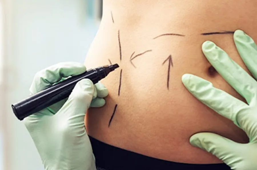 آمار تکاندهنده چاقی در ایران، آیا جراحی لاغری راه توقف دیابت و فشار خون است؟