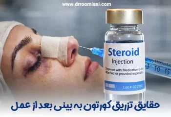 تزریق کورتون به بینی