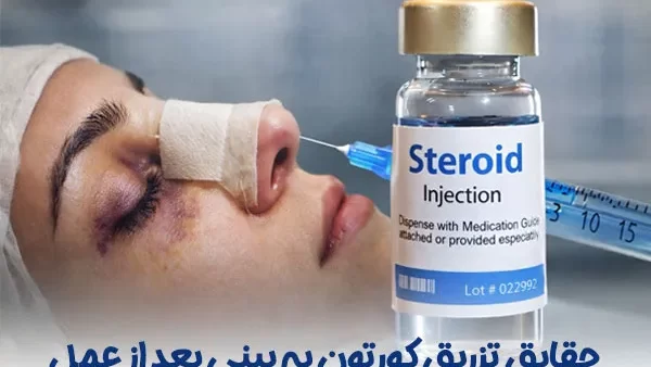 تزریق کورتون به بینی