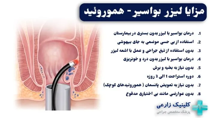 مزایای لیزر بواسیر