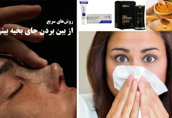 از بینبردنجای از بین بردن جای بخیه بینی + علت و روش های مراقبت از آن