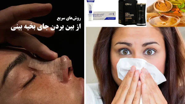 از بینبردنجای از بین بردن جای بخیه بینی + علت و روش های مراقبت از آن