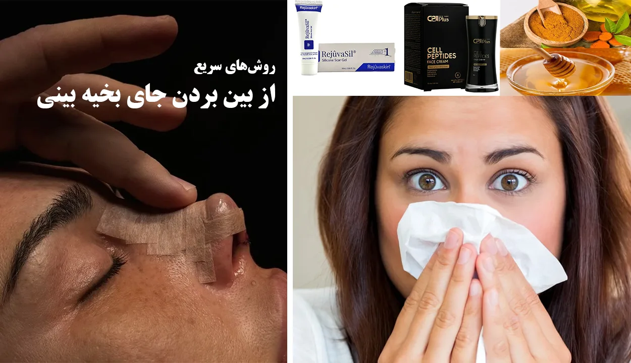 از بینبردنجای از بین بردن جای بخیه بینی + علت و روش های مراقبت از آن